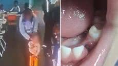 Criança de 3 anos perdeu um dente após se ferir no refeitório de uma escola municipal de Peruíbe; família questiona a conduta de uma professora e o caso é apurado pelas autoridades - Imagem: Reprodução