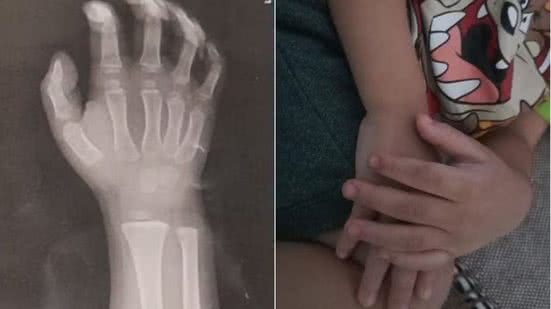 Após investigação, a avó assistiu a filmagens que mostraram a professora agredindo o menino, levantando questões sobre segurança na creche - Imagem: Reprodução | Redes Sociais