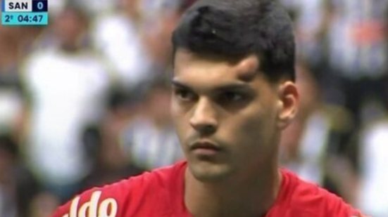 O goleiro do Santos, Gabriel Brazão, sofreu um acidente em campo e precisou ser levado ao hospital após a partida - Imagem: ge/ Santos