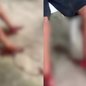 Após ser atacado, a vítima recebeu atendimento do Samu e foi levada ao hospital com cortes profundos nas pernas - Imagem: Reprodução/ Redes Sociais