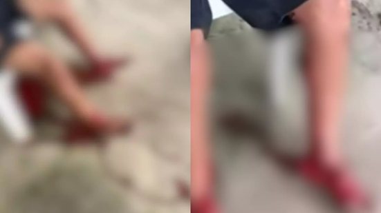 Após ser atacado, a vítima recebeu atendimento do Samu e foi levada ao hospital com cortes profundos nas pernas - Imagem: Reprodução/ Redes Sociais
