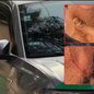 Taxista foi ferido no rosto durante assalto cometido por passageiro dentro de túnel em Santos. Suspeito foi localizado por câmeras de monitoramento e preso pela GCM - Imagem: Reprodução/TV Tribuna