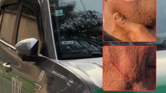 Taxista foi ferido no rosto durante assalto cometido por passageiro dentro de túnel em Santos. Suspeito foi localizado por câmeras de monitoramento e preso pela GCM - Imagem: Reprodução/TV Tribuna