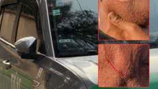 Taxista foi ferido no rosto durante assalto cometido por passageiro dentro de túnel em Santos. Suspeito foi localizado por câmeras de monitoramento e preso pela GCM - Imagem: Reprodução/TV Tribuna