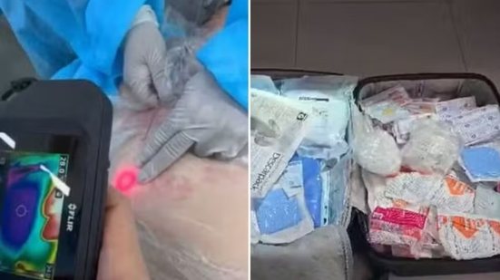 Materiais de uso médico-hospitalar e medicamentos foram apreendidos durante operação da Polícia Civil em clínica investigada por realização irregular de procedimentos estéticos em Santos - Imagem: Reprodução e Polícia Civil