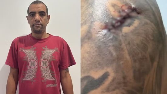 Homem é atacado com faca durante tentativa de assalto em Praia Grande (SP) enquanto passeava com o cachorro - Imagem: Reprodução