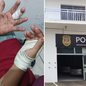 Homem é procurado pela Justiça após atacar a ex-companheira com golpes de faca e tentar estrangulá-la em Registro; vítima possuía medida protetiva contra o suspeito - Imagem: Arquivo Pessoal e Reprodução