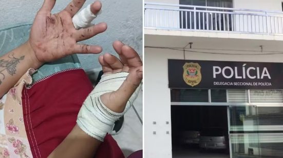 Homem é procurado pela Justiça após atacar a ex-companheira com golpes de faca e tentar estrangulá-la em Registro; vítima possuía medida protetiva contra o suspeito - Imagem: Arquivo Pessoal e Reprodução
