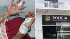Homem é procurado pela Justiça após atacar a ex-companheira com golpes de faca e tentar estrangulá-la em Registro; vítima possuía medida protetiva contra o suspeito - Imagem: Arquivo Pessoal e Reprodução