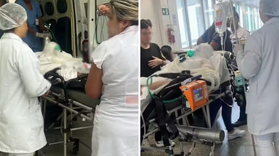 Vítima permanece internada em estado grave após sofrer queimaduras em grande parte do corpo - Imagem: Reprodução
