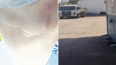 Motorista ficou ferido após ser atingido com cabo de enxada em prédio público de Itanhaém; Justiça entendeu que agressão teve motivação pessoal - Imagem: Reprodução