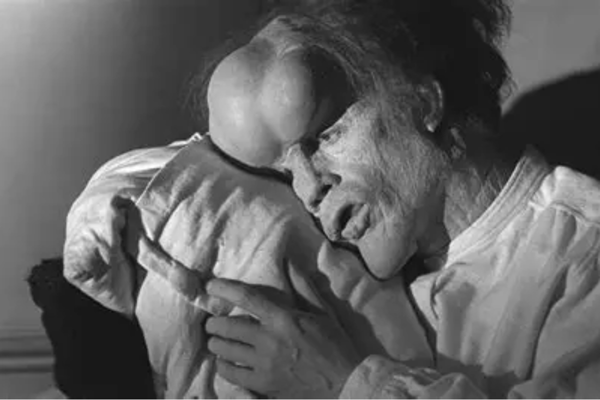 Joseph Merrick: o fascínio moderno pelo extraordinário